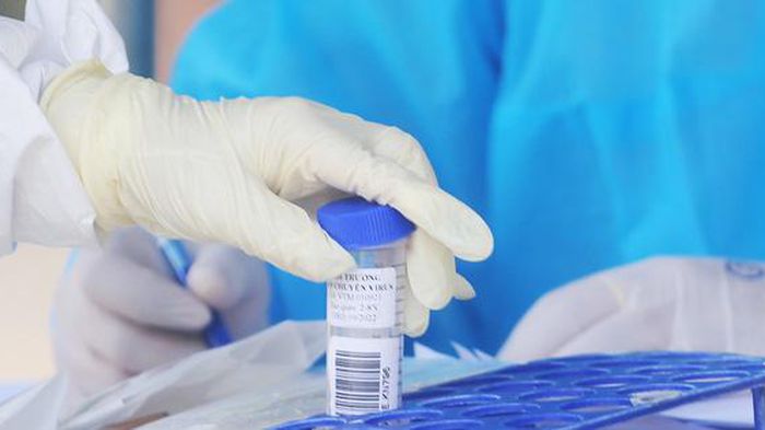 Bộ trưởng Bộ Y tế yêu cầu tăng cường phòng chống dịch trong dịp Tết Nguyên đán; tổ chức tiêm vét vaccine phòng COVID-19